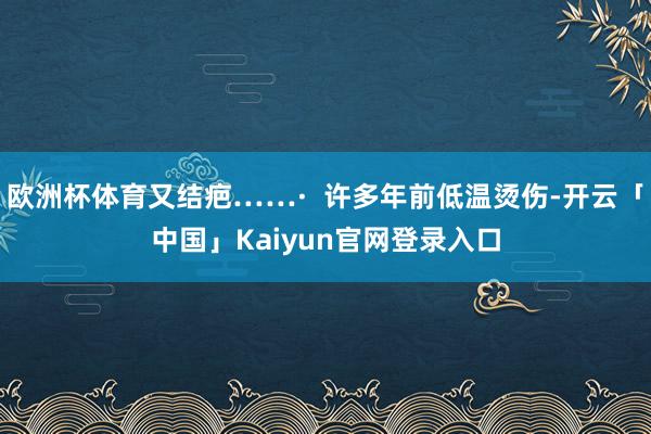 欧洲杯体育又结疤……·  许多年前低温烫伤-开云「中国」Kaiyun官网登录入口
